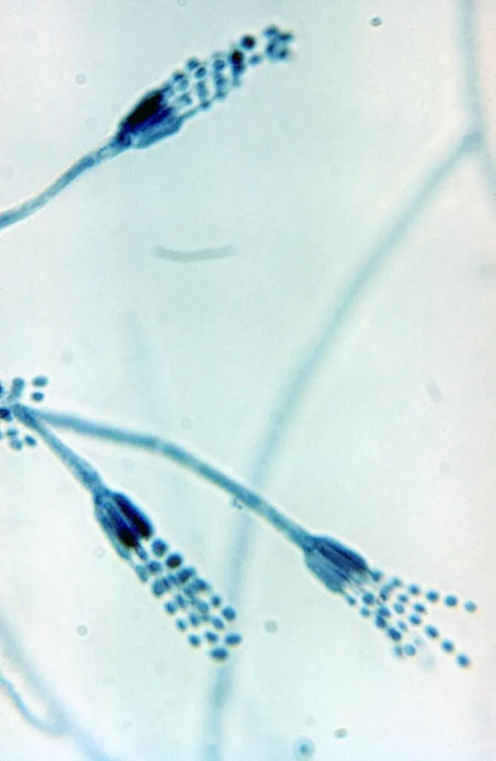 Photomicrograph of Penicillium conidiophores (CDC Public Health Image Library, public domain) — the brush-like spore-bearing structures characteristic of the Penicillium genus.
